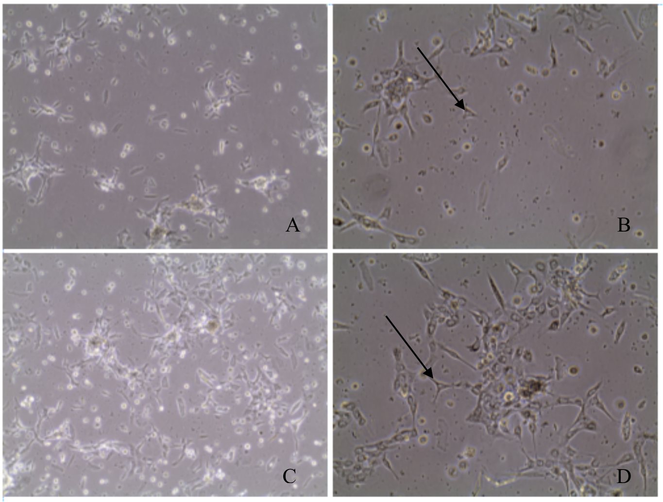 Normal skin keratinocyte culture, 24 h after plating in a T-25, 20x and 40x.