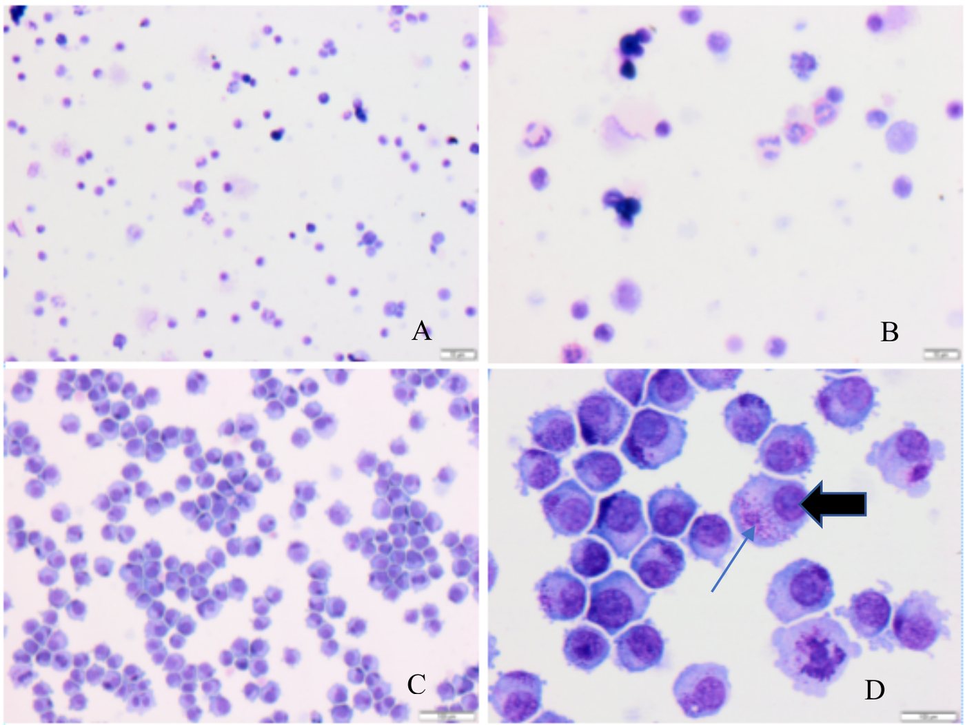 CD117-enriched PBMCs (A, B) beside MPT-1 mast-cell tumor controls (C, D), modified Wright&rsquo;s Giemsa.